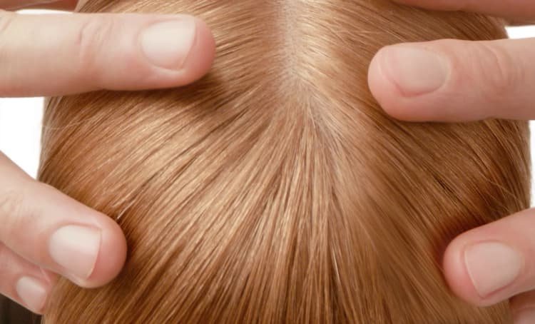 Image showing a Venetian blonde woman's hair and a scalp free from dandruff after following expert advice.